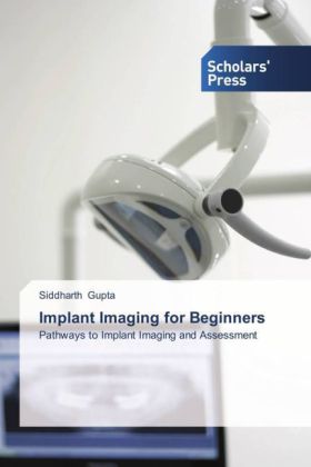 Implant Imaging for Beginners