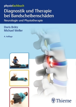 Diagnostik und Therapie bei Bandscheibenschäden