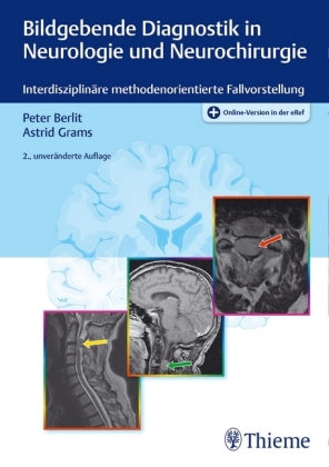 Bildgebende Diagnostik in Neurologie und Neurochirurgie